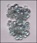 Algae to biocrude